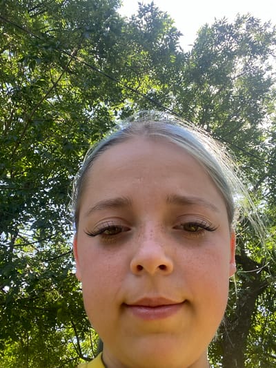 A young person with light skin, freckles, and light blue streaks in their hair is taking a selfie outdoors. Their eyes are open and looking forward, and their lips are slightly parted. They are wearing a yellow shirt. The background is filled with green trees and dappled sunlight. The scene appears to be a park or backyard in a residential area. It is not possible to determine the location within the city of Nova Praha, Ukraine, from the provided image.