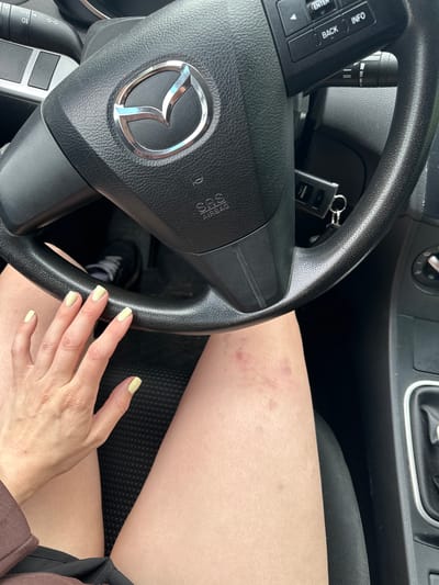 The image shows a close-up view of a person's legs and hand inside a car. The person's left hand, with light yellow nail polish, rests on the steering wheel. Bruising is visible on the person's right thigh. The steering wheel has the Mazda logo in the center and control buttons. A car key is attached to the steering column. The background shows part of the car's interior, including the gear shift and seat fabric. The location is stated to be Zhebrei, Russia.