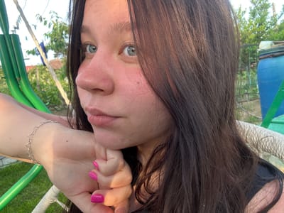 A young woman is depicted in a close-up, outdoor portrait within the city of Byala, Bulgaria. She has long, dark brown hair, with a section draped over the right side of her face. Her blue eyes are directed towards the viewer. Her fair skin exhibits some redness on the nose and cheeks, along with visible pores and a small mole below her right eye. Her lips are closed. She is resting her chin on her left hand, which has fingernails painted a vibrant pink. A silver chain bracelet with heart-shaped links is present on her left wrist. She wears a dark-colored top, partially visible on the right. Strong natural light illuminates her, particularly from the upper right. The background features green metal tubing on the left, potentially part of a swing set, and a white rope. Further back, green foliage, a partial view of a blue plastic barrel, and a white clothesline with hanging items are visible under a bright sky, suggesting a garden or yard environment. A distant roofline of a building is also present.