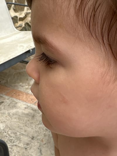 This is a close-up, profile view of a young child's face, captured outdoors. The child's head is turned to the left, revealing their right eye, nose, and cheek. Eyelashes are visible, and the skin appears smooth with some faint lines or marks on the cheek. The child's brown hair, appearing slightly damp, frames the upper part of their head. The background shows a textured surface that appears to be a patio or ground, with a hint of a stone wall and a light-colored object, possibly furniture, on the left. The lighting suggests it is daytime. There is no specific indication of the city of Cannara, Italy.