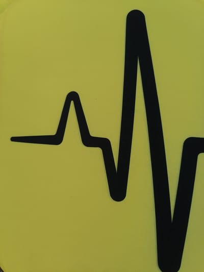This media file is a close-up, eye-level, static shot of a black electrocardiogram (EKG) line graphic on a vibrant, textured yellow background. The EKG line is the sole subject, depicted as a thick, solid black silhouette. It begins on the left with a short, horizontal segment, then rises to a sharp peak, descends, and rises again to a much taller, rounded peak, before descending and continuing off the right edge of the frame. The yellow background appears to be fabric with a visible woven texture. There is no indication of people, a specific scene, or any activity taking place beyond the graphic itself. The lighting is even and bright, suggesting it was taken in good, possibly natural, light. No time of day, weather, or location cues are present within the image itself. There is no visible text. The context provided, "Durankulak, Bulgaria," does not appear to be directly represented in the visual content of the image.