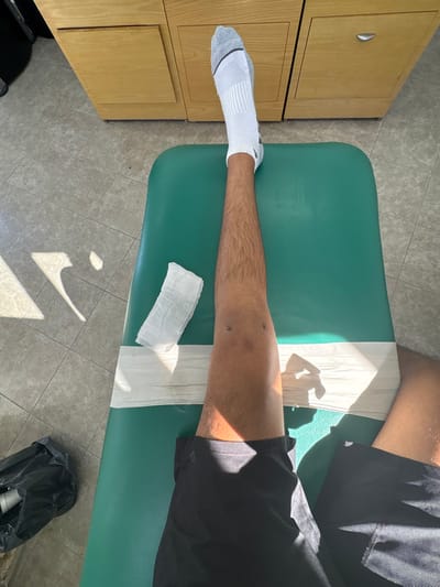 The scene is an indoor medical environment located in Las Crucitas, Mexico. The image captures a first-person, downward view of a person's legs resting on a green examination table. The left leg is fully extended, with the foot clad in a white athletic sock featuring grey trim. The exposed skin of the lower leg is hairy. On the left knee, two small, dark, circular marks are visible, consistent with recent surgical incisions or suture sites. A folded white gauze pad rests on the green table surface to the left of the knee. A wider strip of white medical tape or bandage is wrapped around the upper portion of the left shin/lower thigh. The right leg is partially visible on the right side of the frame, wearing dark-colored shorts. The floor consists of light-colored tiles, and in the background, light brown wooden cabinetry with recessed panels and a silver pull handle on one door is visible. A black plastic bag is situated on the tiled floor to the lower left of the table. Strong, directional lighting casts prominent shadows across the floor and the subject's legs.