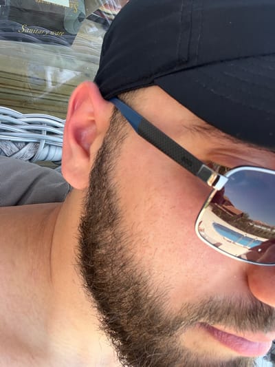 The image shows a close-up, high-angle shot of a person's face, featuring their right ear, partial beard, and sunglasses, with a black baseball cap obscuring the top of their head. The background is blurred, but appears to be a store interior with reflective surfaces and wicker furniture. Text on a reflective surface in the background reads "Sanitary ware". The sunglasses reflect a swimming pool and buildings. The person is likely outdoors, in a location with amenities such as a pool. The location is specified as Lozen, Bulgaria, suggesting an outdoor setting or a store located there.