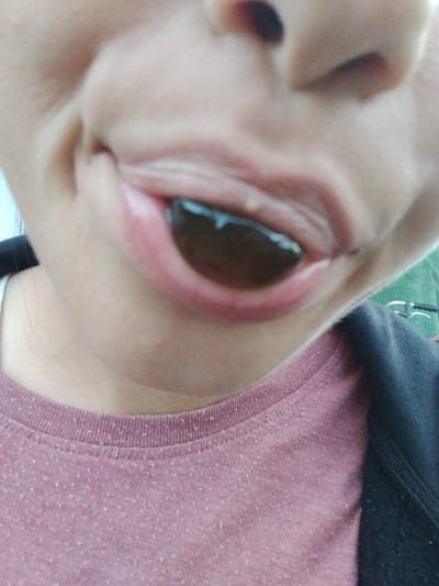 A close-up, low-angle shot shows the lower face of an individual with a dark substance, possibly a gummy candy, on their tongue. The person is wearing a pinkish-maroon t-shirt with a flecked pattern and a dark-colored jacket over it. The background is out of focus, with a hint of green vegetation and what appears to be part of a bicycle on the right side. The image was taken in Cîrpești, Moldova.