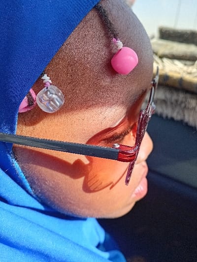 A close-up, right-profile image depicts a person in Sharada, Nigeria. The individual exhibits a dark brown complexion and wears a royal blue head covering. Visible on the exposed scalp are small braids, two of which are adorned with decorative beads: one solid pink and rounded, the other clear and faceted, secured by small threaded wraps. The person wears dark-framed eyeglasses with reddish-brown tinted lenses, which cast distinct shadows across the right cheek and eye area. The lips are closed. Strong sunlight illuminates the scene, indicating an outdoor or brightly lit indoor environment. The background is out of focus, showing indistinct light and dark elements.