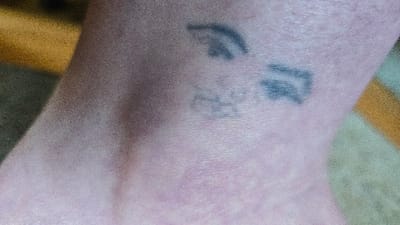 The scene is a close-up image of human skin, likely an ankle or lower leg, displaying multiple faded dark blue-grey tattoos. The location is Lompoc, United States. A prominent, faded, dark blue-grey abstract shape resembling an incomplete arc or crescent is positioned centrally in the upper left of the visible tattooed area. To its right, another faded, irregular dark blue-grey shape, roughly rectangular or block-like, is present. A third, significantly fainter and more blurred light grey mark is visible between and slightly below the two more distinct tattoos. The surrounding skin is light-toned, exhibiting minor surface texture and slight redness in areas. The background is out of focus, composed of blurred color fields: a golden-yellow section appears in the upper left and diagonally towards the right, transitioning into darker green-brown and lighter beige/pale green areas, suggesting an indoor setting with varied surfaces. No other individuals, distinct objects, or actions are depicted.