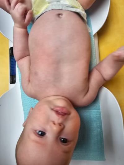 An infant, likely a baby, is positioned on a white baby scale with a teal-colored mat. The infant is wearing a diaper and is lying on their back. The baby's head is at the bottom of the frame, with its eyes open and looking towards the camera. The baby's mouth is slightly open. The scale has a digital display showing "0.0000". The scale is placed on a yellow surface. The image is taken from a top-down perspective and is rotated counter-clockwise. The scene appears to be indoors, possibly in a medical or home setting. The location of Tavernier, United States is not discernible from the image itself.