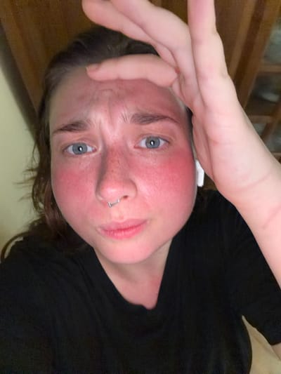 The media file is a close-up, low-angle, indoor portrait of a young person. The subject's head is tilted back, and their face is the primary focus. Their skin is flushed red, particularly on the cheeks and forehead, suggesting a possible sunburn or blush. They have light-colored eyes, noticeable freckles across their nose and cheeks, and dark eyebrows. A silver, square-shaped septum piercing is visible on their nose. The person is wearing a black t-shirt.
Their left hand is raised and resting on their forehead, obscuring part of their hairline and upper forehead. The background is dimly lit and appears to be an indoor setting with wooden furniture or paneling visible to the left, suggesting a home or a similar environment. The lighting is warm and suggests an evening or indoor setting. The overall emotion conveyed by the subject is one of weariness or discomfort, possibly due to the flushed skin. No text is visible in the media file. The location context provided is Stryi, Ukraine, but this cannot be visually confirmed from the image itself.