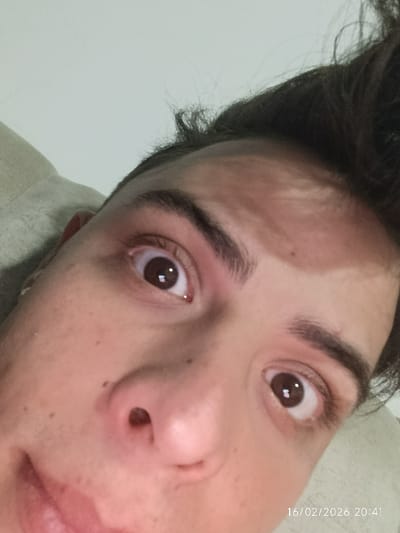 A close-up, angled view of a person's face, predominantly featuring their eyes, nose, and forehead. The person has dark hair and brown eyes. Skin blemishes are visible. The date "16/02/2026 20:41" is printed in the lower right corner. The background suggests the person is reclining on a soft surface. The lighting appears to be soft and diffused. The subject's gaze is directed upwards and to the left.