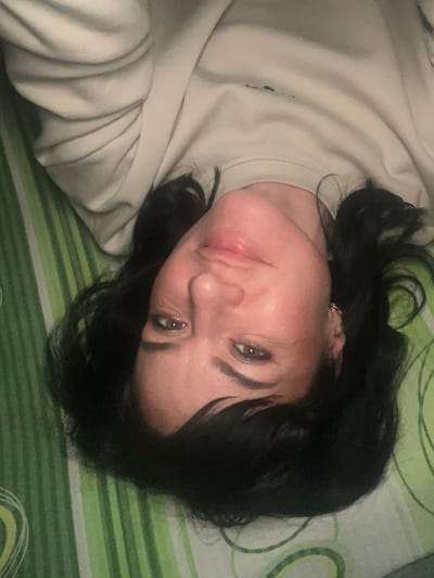 An indoor scene depicts an adult female lying supine, with her head inverted towards the bottom of the frame, looking directly at the camera. She has dark hair and brown eyes, and is wearing a light-colored (beige or light grey) crewneck sweatshirt. A visible swelling is present on her upper lip, superior to the philtrum, on the viewer's left side of her face. A small, golden-colored hoop earring is visible in her right ear. The individual is resting on a surface covered by a textile featuring a pattern of vertical stripes in various shades of green, with intermittent lighter, abstract circular or spiral designs. The specific location within Smederevska Palanka Municipality, Serbia, cannot be determined from the visual evidence in the image.