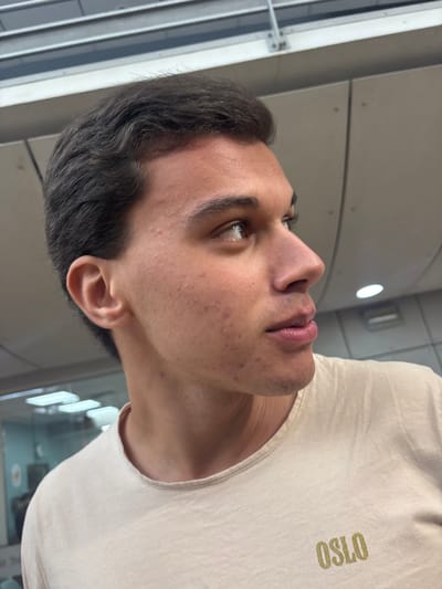 The image depicts a young male individual from the mid-chest up, positioned in a profile-like view, facing towards the right side of the frame and looking upwards. He has short, dark brown, wavy hair. His skin tone is light, displaying multiple small erythematous papules and macules consistent with acne on his forehead, temples, cheeks, and chin. His eyes are light in color, and his lips are closed. He exhibits faint stubble on his upper lip and chin. He is wearing a light beige short-sleeved t-shirt with a round neckline. The word "OSLO" is printed in a light brown or gold color on the lower front right side of the shirt. The background is out of focus, indicating an indoor environment with artificial lighting. Visible elements in the background include a light-colored ceiling with panels and metal structures, and a blurred reflection in what appears to be a glass partition. The specific location within the city of Porto Salvo, Portugal, is not discernible from the visual information provided.