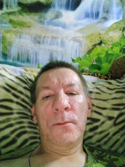 The image depicts a single adult male, viewed from above, lying supine on bedding that features a green and black striped pattern. The individual has short, dark hair and a reddish complexion with prominent pores and some uneven skin texture on his face; his eyes appear partially closed or squinting. The background consists of a wall-mounted tapestry or poster illustrating a multi-tiered waterfall cascading through a lush, green, forested landscape. A small, dark, unidentifiable object and a narrow, leopard-print band are partially visible on the bedding in the upper right quadrant. The scene is indoors, presumed to be within the city of Kamensk-Shakhtinsky, Russia. The photograph exhibits noticeable image noise and a soft focus.