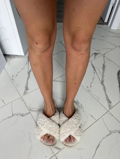 The image shows the lower legs and feet of a person wearing white fluffy cross-strap slippers. The person has tan skin and appears to have two small, minor abrasions, one on each knee. The floor is tiled with a white marble pattern. The background includes a white appliance, possibly a washing machine, and a white door frame. The scene is indoors, with artificial lighting. The location of Нижнеяркеево, Russia is not visually discernible from the image itself.
