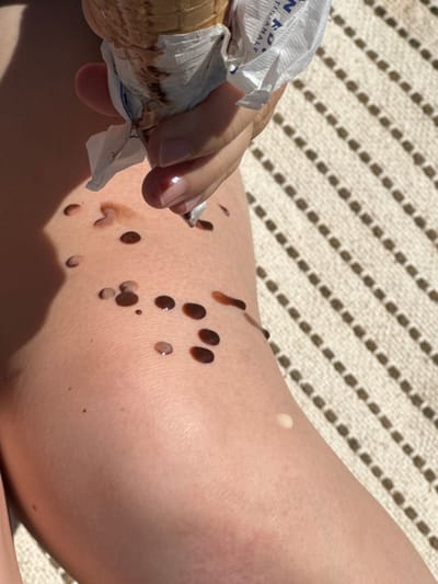 A high-angle close-up depicts a light-skinned person's leg and hand holding a melting ice cream cone. The scene is located in Abbadia Lariana, Italy. The hand, with manicured nails, grips a waffle cone partially enclosed by a white paper napkin. Melted dark brown substance, consistent with chocolate ice cream, drips profusely from the cone, forming numerous distinct droplets on the upper thigh and knee. A single lighter-colored droplet is visible on the lower leg. Partial text, including 'NAZIONALE', is visible on the cone's wrapper. Strong, direct sunlight casts sharp shadows across the leg and the diagonally striped woven mat forming the background.