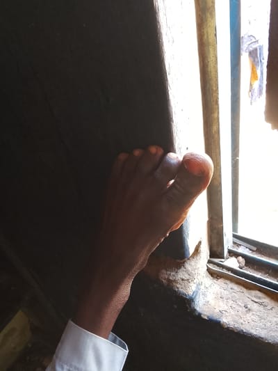 A close-up shot focuses on a person's bare foot resting on a rough, weathered windowsill. The foot, with its toes exposed, is dark-skinned and shows signs of dryness around the nails. The person is wearing a white collared shirt, visible at the bottom of the frame, suggesting a formal or semi-formal attire.

The setting appears to be indoors, near a window. The windowsill itself is worn and textured, with small stones and debris scattered on it. The window frame is made of metal and is somewhat weathered. Through the window, bright daylight streams in, creating a strong contrast with the darker interior. The light suggests it could be daytime, possibly late morning or early afternoon, given its intensity.

The scene is stark and simple, with no other people or significant objects visible besides the foot, the shirt, and the immediate window area. The overall mood is quiet and still. The background on the left is dark and indistinct, possibly a wall or furniture. No text is visible in the image. The location context of Sunkani, Nigeria, might suggest a warm climate, which could explain the bare foot and the bright sunlight.