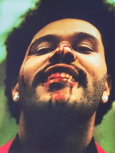 The image is a close-up, low-angle, slightly out-of-focus portrait of a man's face, heavily cropped from the shoulders up. He has dark, curly hair, dark skin, and is wearing a red garment with a bright green background that appears out of focus. His head is tilted back, and his mouth is open, revealing teeth that are also red. There is noticeable blood on his nose, upper lip, and cheeks, with a streak of blood running down his left cheek. He is wearing small, circular earrings in both ears. The overall impression is one of distress or injury. The image does not contain any elements that would indicate a specific location within Pletena, Bulgaria.