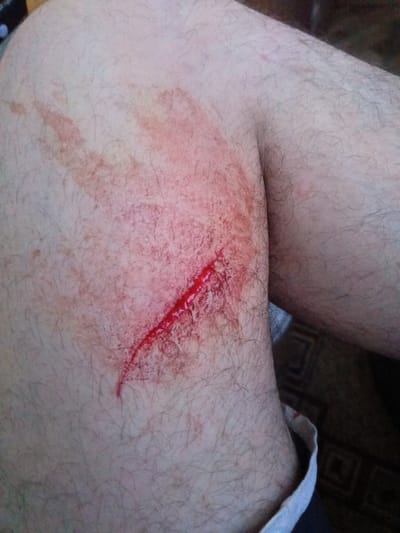 The image shows a close-up view of a bleeding laceration on a person's leg. The wound is bright red and appears to be fresh. There is also some redness and abrasion around the wound, suggesting it may have been caused by a scrape. The leg is covered in fine, dark hair. The background is out of focus but appears to be an indoor setting with a patterned floor. There is no discernible information within the image to indicate the location of Parabel, Russia.