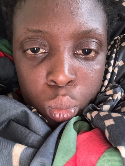 A close-up, eye-level, medium shot captures a person's face, centered and looking directly at the camera. They are wrapped in a colorful scarf featuring a geometric pattern of black and light beige squares, along with solid sections of red, green, and grey fabric. The person's skin appears to be dark, with some texture and slight sheen. Their lips are full and slightly parted, revealing a light pink hue. The background is obscured by the scarf and the person's hair, which is dark and pulled back. The overall lighting suggests an indoor setting, likely a bedroom in Jawu, Nigeria, given the context.