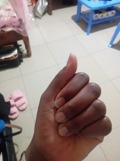 A person’s left hand, dark-skinned, is closed in a loose fist, with the thumb extended slightly. The fingernails are short and unpolished. A bracelet is visible on the wrist. The hand is positioned over a light-colored tiled floor. In the background, there are items including a blue plastic step stool and a pink fluffy object on the floor. Some luggage is also visible. The photograph appears to be taken indoors under artificial lighting.