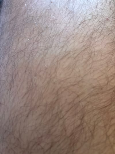 The image displays a close-up view of human skin with fine, light-colored hairs. The skin appears to be a light to medium tone. The hairs are dispersed across the surface, some catching the light and appearing slightly reflective. The texture of the skin suggests a natural, unedited surface. There is no discernible background or context provided by the image. No information is available regarding the location in Yanevo, Russia.