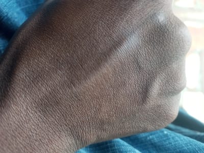 The image shows a close-up view of a human hand resting on a blue fabric, likely clothing. The hand is clasped, with the knuckles and veins prominently visible. The skin texture is detailed, showing pores and fine lines. The lighting suggests an indoor or shaded environment. The location is not determinable from the image alone and there is no contextual information to place it in Agbara, Nigeria.