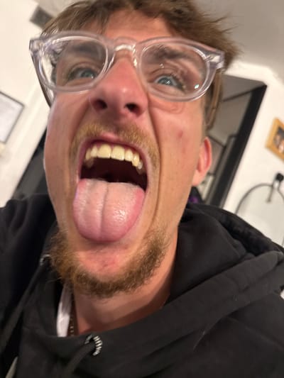 A man with light skin, blue eyes, and a beard and mustache wears clear-framed glasses. His mouth is wide open, revealing teeth and a tongue. He's wearing a black hooded sweatshirt. The background is blurry, but it appears to be a room with a picture frame on a wall and a metal object. The image is tilted to the side.