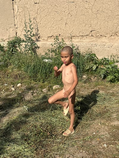 A young boy, appearing to be around five years old, lies on his back in dry grass next to a cracked, earthen wall. He is naked, with a shaved head and a somber expression on his face. His right hand rests on his stomach, and his left arm is bent, with his hand near his face. His legs are extended, and he is wearing light-colored sandals on his feet.
The scene appears to be outdoors, in a dry, possibly rural or undeveloped area. The sunlight suggests it is daytime, casting a distinct shadow of the boy and surrounding vegetation on the ground. The wall behind him is textured and shows signs of weathering and cracks. Green and dry grass, along with some scattered leaves and small white flowers, cover the ground. The boy's posture and facial expression do not clearly indicate a specific activity, but he appears to be resting or lying down. The overall impression is one of simplicity and perhaps hardship, given the stark environment and the boy's attire. There is no visible text in the image. The provided location context of Kyrgyzstan suggests a setting in Central Asia.