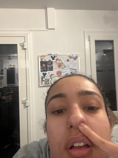 A selfie shows a woman with dark hair and eyebrows, fair skin, and a nose ring, pinching her nose. Her mouth is slightly open, revealing a piercing. The background includes a white wall with a window and a whiteboard covered in papers, magnets, and other items. A white door and more of the wall are visible. The image is taken at an angle.