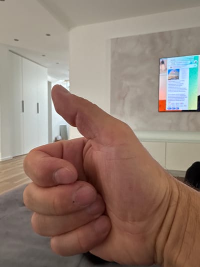The image shows a close-up view of a person's right hand giving a thumbs-up gesture. The hand is the primary subject, with the thumb extended upwards and the fingers curled into a fist. The skin tone is fair, and some wrinkles are visible on the hand.
In the background, a modern living room is visible. To the left, there are tall white closet doors with black handles. Further back, a hallway leads to a dimly lit area. In the center and right of the background, a large flat-screen television is mounted on a wall decorated with a textured, marbled wallpaper. The TV screen displays a news article with text and an image of a dome. Below the TV, a white cabinet unit is present. The flooring appears to be light-colored wood.
The image does not provide any information that would allow for determining its location in the city of Oberleichtersbach, Germany.
