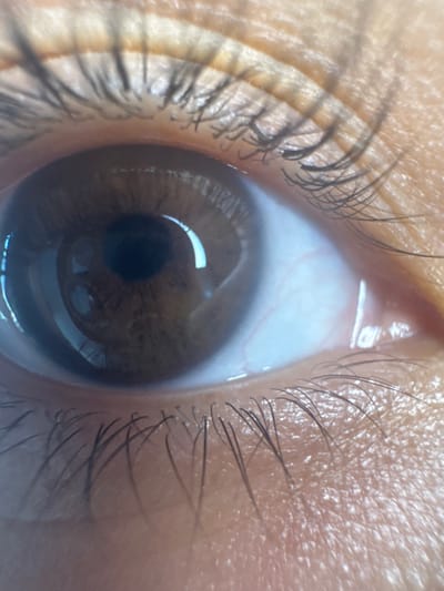 This is a macro photograph of a human eye. The eye is brown with a visible iris and pupil. Eyelashes frame the upper and lower eyelids. The skin surrounding the eye is visible, showing texture and fine lines. The sclera, or white part of the eye, is also visible, with fine blood vessels. There is a reflection of light on the surface of the eye. The image does not contain any information that would allow for its location in the city of Belashtitsa, Bulgaria, or any other specific location.