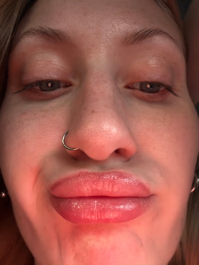 The image is a close-up, low-angle shot of a woman's face, focusing on her lips, nose, and eyes. Her lips are full and appear to be coated with a glossy substance, possibly lip gloss or balm. She has a silver hoop piercing in her left nostril. Her eyes are open, with dark pupils and what appear to be dark eyelashes. The lighting is warm and reddish, casting a glow on her skin, which has visible pores and some freckles. The background is dark and indistinct. The provided information about the location in the city of Imeni Morozova, Russia, is not visually verifiable from the image itself.