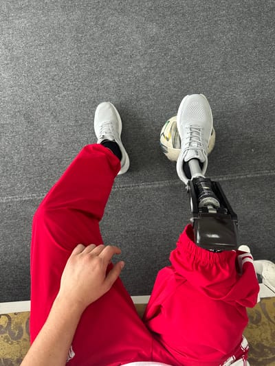 The image shows a person's legs and torso from a high-angle perspective. The person is wearing bright red pants and a white top, with a prosthetic leg on the right side. A soccer ball is positioned beneath the prosthetic foot. The background is a grey carpeted surface. There are no identifiable landmarks or clues to suggest the location is Belbulak, Kazakhstan.