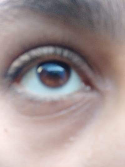 A close-up, blurry view of a brown eye is captured. The iris reflects light, and distinct eyelashes frame the upper eyelid. The surrounding skin shows fine lines and a slight crease under the eye. Skin tone is warm, and the overall image lacks sharp focus.