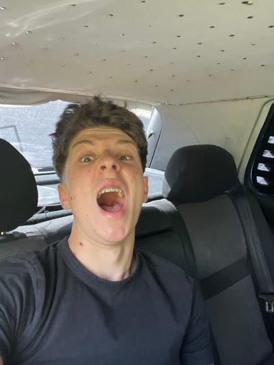 The image shows a young person with braces in a vehicle, likely a van given the visible interior features. The person is looking directly at the camera with their mouth open, displaying their braces. They are wearing a black t-shirt. The interior of the vehicle features a patterned ceiling with small, circular indentations and the dark upholstery of seats is visible. The overall lighting suggests it is daytime.