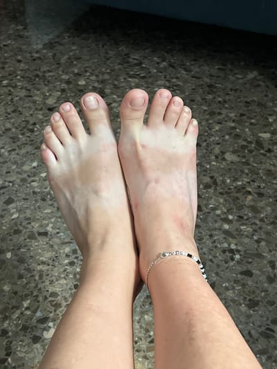 The image presents a top-down view of two bare human feet and lower legs resting on a dark, speckled floor, possibly made of terrazzo or a similar material. The subject has light skin, which displays prominent variations in pigmentation, characterized by several lighter, less-tanned patches across the tops of the feet and extending up the ankles and lower calves. Scattered small reddish spots are also visible on the skin of both feet and ankles.

On the right ankle, a delicate anklet is worn, featuring small black, white, and translucent beads strung together with a silver chain and clasp. The toenails appear to be unpolished or have a very light, natural-colored polish, with some showing minor discoloration or unevenness. The feet are positioned side-by-side, with the right foot slightly overlapping the left. The scene is static, depicting the feet at rest. The lighting suggests an indoor or covered outdoor environment. There is no visible text in the image. The context for the image is Picassent, Spain.