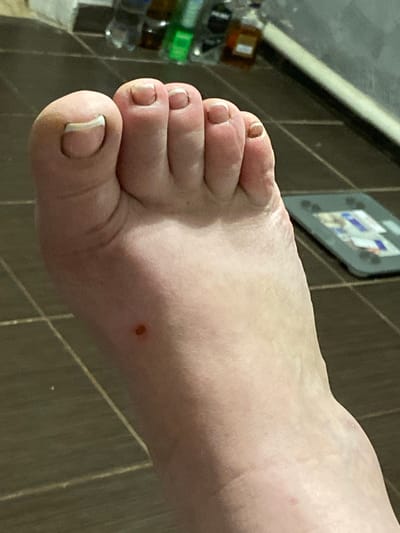 A close-up, high-angle, full-body shot shows a pale-skinned foot with five toes and toenails. The foot is positioned on a tiled floor, which is dark brown with light-colored grout lines. In the background, out of focus, are several bottles of liquids, some of which appear to be green or brown, and a gray electronic device with some colored markings. There is a small, dark brown circular mark on the top of the foot. The scene appears to be indoors, possibly in a bathroom or laundry area. There are no people visible other than the foot. The lighting is artificial and somewhat harsh, casting subtle shadows. The image was captured in the city of Rozkvit, Ukraine.