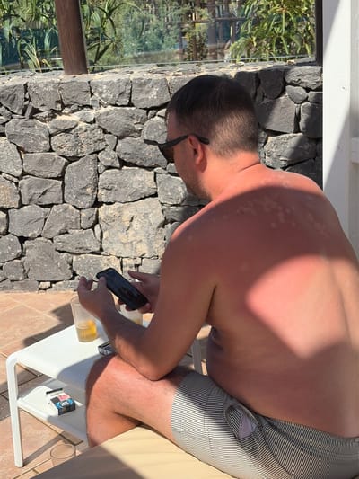 A person is sitting outdoors, possibly in a resort or hotel courtyard in Antigua, Spain, with a stone wall in the background and a tiled floor in the foreground. The person is wearing sunglasses and striped shorts. Their upper body is bare and appears sunburned, with visible red skin and lighter patches. They are holding a smartphone in their left hand and a cigarette in their right hand. On a white table next to them, there is a glass of amber liquid, a pack of cigarettes, and another glass. Lush green foliage is visible beyond the stone wall. The lighting suggests it is daytime, with strong sunlight casting shadows.