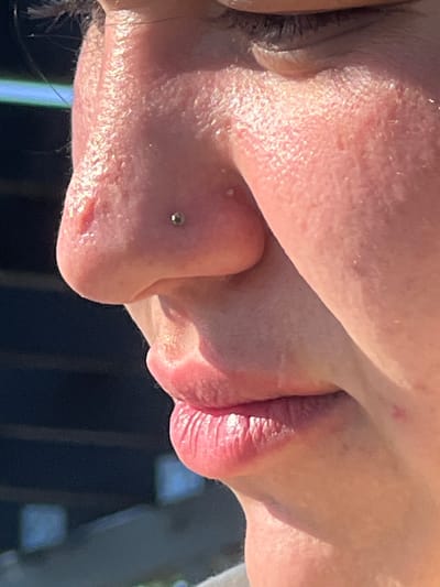 This is a close-up, angled photograph of a person's face, specifically focusing on the nose, lips, and a portion of the eye and cheek. The skin appears flushed, with visible pores and some minor blemishes or redness. There is a small, silver stud piercing on the side of the nose. The lips are full and slightly parted, showing textured detail. The lighting suggests it might be daytime, with a bright, diffused light source illuminating the skin, creating a slight shimmer. The background is out of focus and appears to be dark, with some blurred vertical lines that could suggest a window frame or similar architectural element. The composition is tight, with no clear indication of a specific setting beyond the suggestion of an indoor or close-up portrait. No text is visible in the image. The overall impression is an intimate and detailed portrait of facial features.