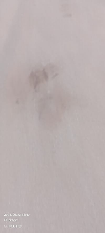 A close-up, blurry, abstract image of a textured surface, possibly skin, with a small, dark, irregular mark in the center. The mark appears slightly raised or discolored, with some lighter speckles around it. The background is a uniform, pale, neutral color, suggesting a diffused light source and minimal shadow. The overall impression is one of a very intimate, almost microscopic view of a surface.
In the bottom left corner, there is visible text. The date and time are displayed as "2026/06/23 18:40". Below this, the words "Enter text" are visible. Finally, a logo appears as "© TECNO".
The context provided places this image in Gumel, Nigeria. Given the close-up nature and the appearance of the central mark, it's possible this is a detail of skin, perhaps a blemish or a mark that requires documentation or a closer look. The time stamp indicates it was taken in the early evening. The texture and lighting suggest an indoor setting, or an outdoor setting with soft, ambient light. The presence of the "TECNO" logo suggests the image was captured with a TECNO mobile device.