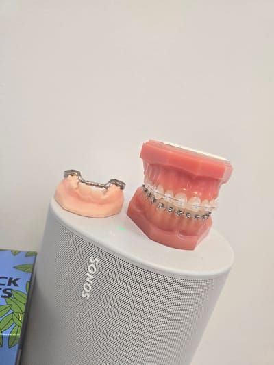 The image depicts a pair of dental models (upper and lower jaws) positioned on top of a white Sonos speaker. The upper dental model has visible braces. The Sonos speaker is cylindrical and has the word "SONOS" printed on its surface. A green LED indicator light is visible on the speaker. The objects are situated near a white wall. Part of a book with a blue cover and green leaf designs is visible at the bottom of the frame. The photograph does not specify a location within Mouscron, Belgium, nor does it suggest any actions or interactions are taking place.