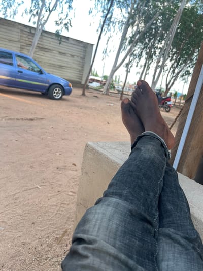 In Mayo Dasa, Nigeria, a person is relaxing outdoors. Their bare feet, with dark skin, are crossed at the ankles and rest on a concrete block. They are wearing dark denim jeans, with the cuffs rolled up. In the background, a blue car is parked on a dirt ground. Several trees with slender trunks and sparse foliage are visible, with thin branches reaching towards a bright sky. A rustic wooden structure with a white vertical beam is to the right. Beyond the trees, a red motorcycle and other structures can be faintly seen. The overall environment suggests a casual, open-air setting.