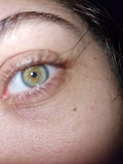 A close-up photograph shows the left eye of a person with hazel-colored iris surrounded by a white sclera. The pupil is black. The lower eyelid has a slight tear. Eyelashes are visible on both the upper and lower eyelids. The eyebrow is brown. The skin around the eye is light and has visible pores, fine lines, and a few small moles. The top of the forehead is visible, with stray dark hairs. There is no evidence to suggest this image was taken in Byala Slatina, Bulgaria.