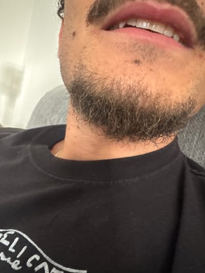 The image is a close-up, horizontally oriented shot of a person's lower face, neck, and upper chest, seen from a side profile. The subject has a dark, curly beard with some visible grey hairs, covering their cheeks and chin. Their lips are slightly parted, revealing clean, white upper teeth. The skin tone is light to medium, with some stubble visible and a small mole present on the cheek/jawline area.

The person is wearing a black t-shirt with a rounded neckline. A faint, thin gold chain is visible around their neck. On the black t-shirt, part of a white, stylized text or logo is visible, appearing to spell "PELI CAN". The background consists of a light grey, textured surface (possibly fabric like a pillow or blanket) behind the person's head and a lighter, out-of-focus area, possibly a wall, to the lower left.

The activity appears to be the person's mouth slightly open, which could indicate a relaxed expression or a subtle smile. No specific time of day or weather is discernible from the indoor setting. The location context of Redondo Beach, United States of America, is provided but not explicitly identifiable from the visual content. The image captures a casual and personal moment.