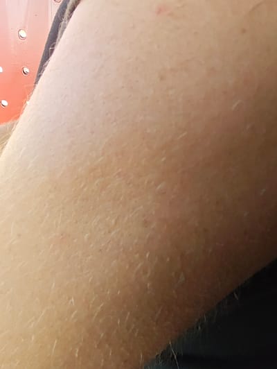 This close-up image shows a person's arm, with fine hairs visible on the skin. The skin appears to be light-skinned with some minor imperfections, possibly freckles or small marks. In the upper left corner, a portion of an object with a coral or orange color and a series of circular holes is visible. This object appears to be made of metal and has a perforated design, possibly a part of a piece of furniture or equipment. The background is dark, suggesting a shadow or the presence of clothing. The lighting in the image is somewhat diffused, indicating it could be daylight but without direct sunlight. The overall tone of the image is neutral, with no strong emotional cues conveyed. There is no visible text in the image. The location context provided is Краснадворскі сельскі Савет, Belarus, which is a rural administrative region.