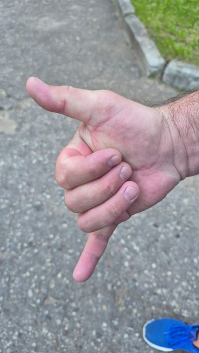 The image features a close-up view of a person's hand, extended downwards. The hand is forming a gesture that resembles the "shaka" sign, with the thumb and pinky finger extended while the other fingers are curled inward. The skin on the hand appears fair and shows some signs of wear. The background consists of a grey, textured surface, possibly asphalt or concrete, with scattered pebbles. To the left of the hand, a blurry patch of green grass and a concrete curb are visible, suggesting an outdoor setting. In the upper right corner, the edge of a blue athletic shoe with white laces is partially visible, indicating the presence of another person. The lighting suggests it is daytime. There is no visible text in the image. The scene is likely a casual outdoor environment, possibly a park or a street in Krauja, Latvia, based on the provided location context. The activity appears to be a person making a hand gesture.