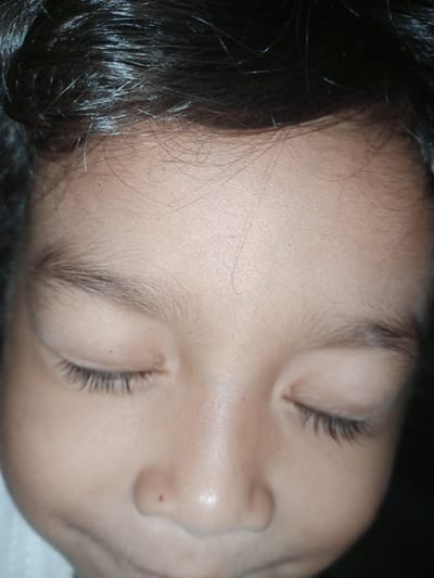 The image shows a close-up, head-on view of a young child's face with their eyes closed. The child has dark hair, fair skin, and prominent eyelashes. The lighting is somewhat dim, casting shadows on the face and highlighting the texture of the skin and hair. The background is dark and out of focus, suggesting the photograph was taken indoors. There are no identifiable landmarks or elements within the image that would indicate a specific location, city, or country. Therefore, it is impossible to determine if this image is from Cotseutui, Indonesia, based solely on the visual information provided.