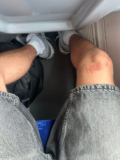 The image shows a close-up view of a person's legs from a seated position, likely within a vehicle. The person is wearing grey denim shorts and white socks with grey and white athletic shoes. A notable detail is a scraped or bruised area on the person's right knee, appearing red and raw. Beside the legs, a black backpack is visible. The setting appears to be confined, with a white plastic surface on the left, possibly part of a seat or wall, and a dark floor. The person is sitting in what could be a train or bus, given the confined space and the texture of the interior in the background. The lighting suggests it is daytime. There is no visible text in the image.