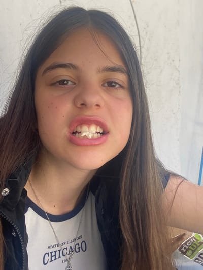 A young woman is posing for a photo. She has long brown hair, brown eyes, and is wearing a white t-shirt with "Chicago State of Illinois 199_" printed on it, along with a black jacket and silver necklace. She is smiling and has white material between her front teeth. The background appears to be a light-colored, possibly concrete or painted surface. Based on the available information, no specific location in Dragovishtitsa, Bulgaria, can be determined.