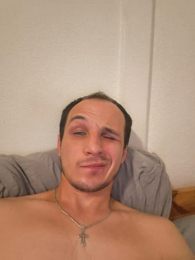 A shirtless man with a bruised eye and a silver cross necklace is lying down, propped up against a grey pillow, indoors. The background consists of a textured, cream-colored wall with a vertical line that may indicate a seam or shadow. The man is looking directly at the camera with a slight grimace or squint. The lighting is soft and appears to be coming from the front. There are no other people or significant objects visible in the frame. The exact location within Quickborn, Germany cannot be determined from the provided image.