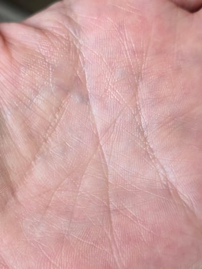 The media file is an extreme close-up photograph of a human palm. The skin is pale pink with visible lines and creases characteristic of a palm. The texture of the skin is detailed, showing small ridges and pores. The lighting suggests it is indoors or in a shaded area, as there are no harsh shadows, and the light is diffused. The focus is entirely on the skin's surface, with no other objects, people, or background elements clearly discernible. There is no visible text or discernible activity. The context of Nova Kakhovka, Ukraine, is provided externally and cannot be inferred from the image itself.